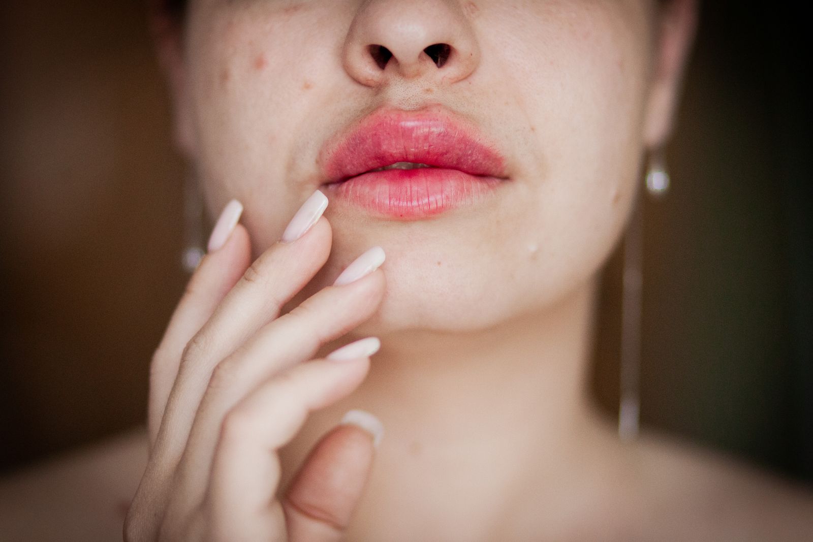Lip Lifting