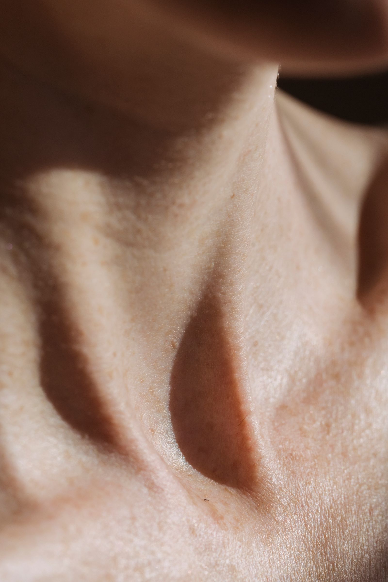 Platismoplastia