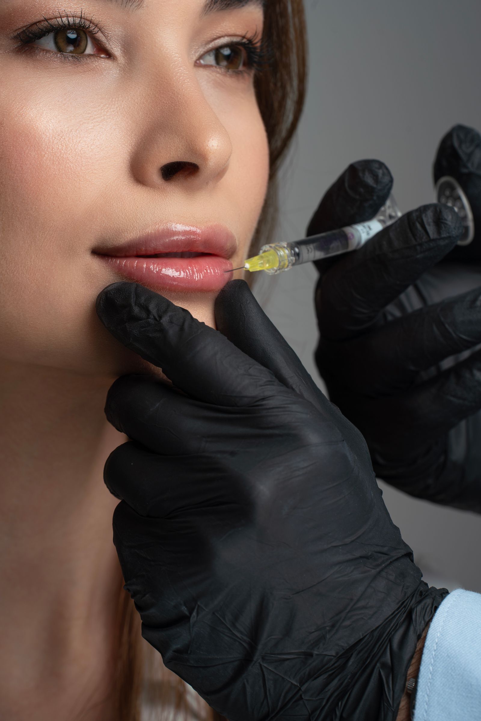 Preenchimento Labial